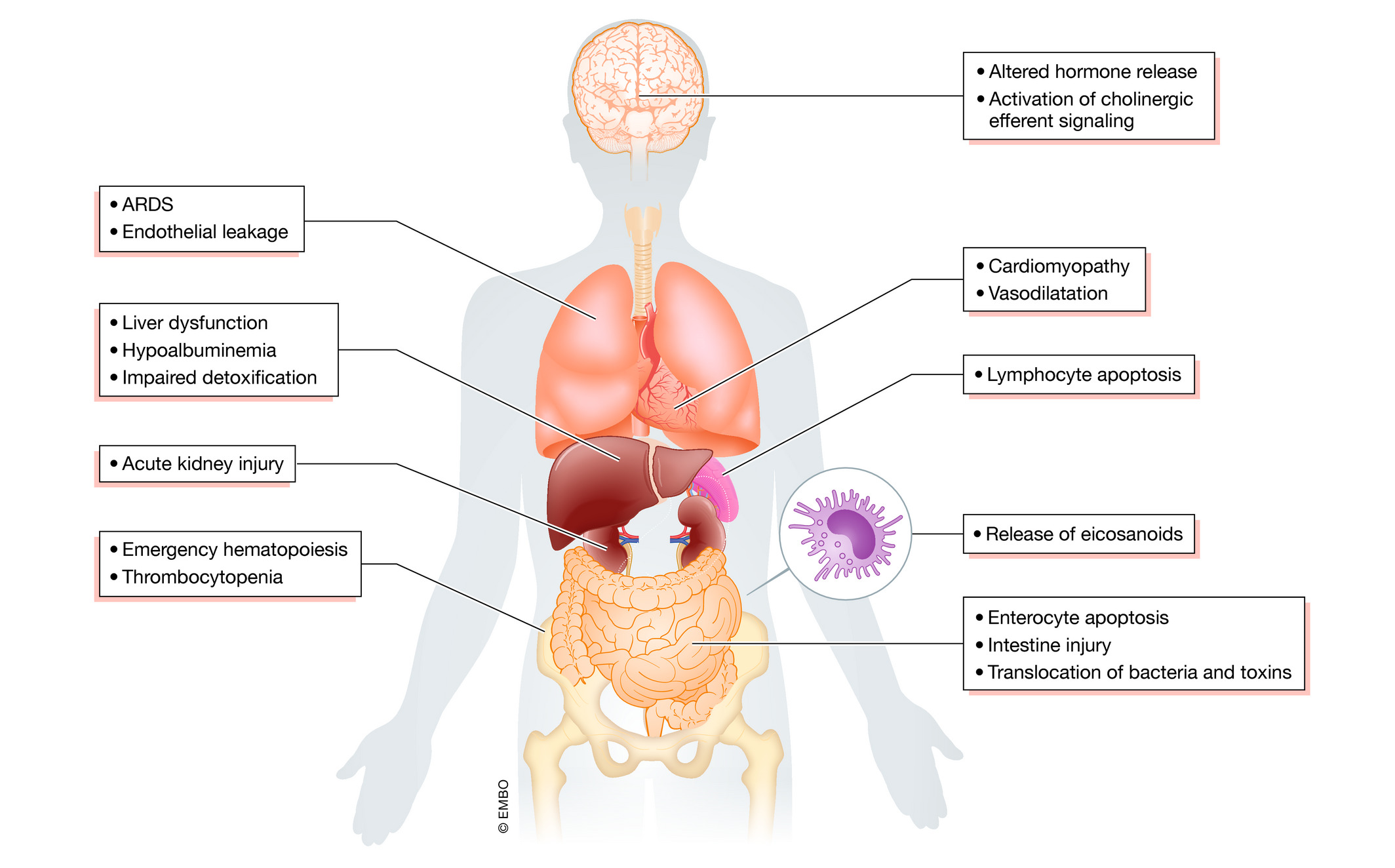 Sepsis therapies – learning from decades of translational research