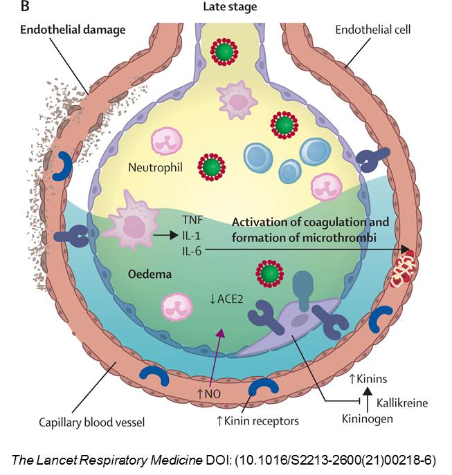 The COVID-19 puzzle: deciphering pathophysiology and phenotypes of a new disease entity